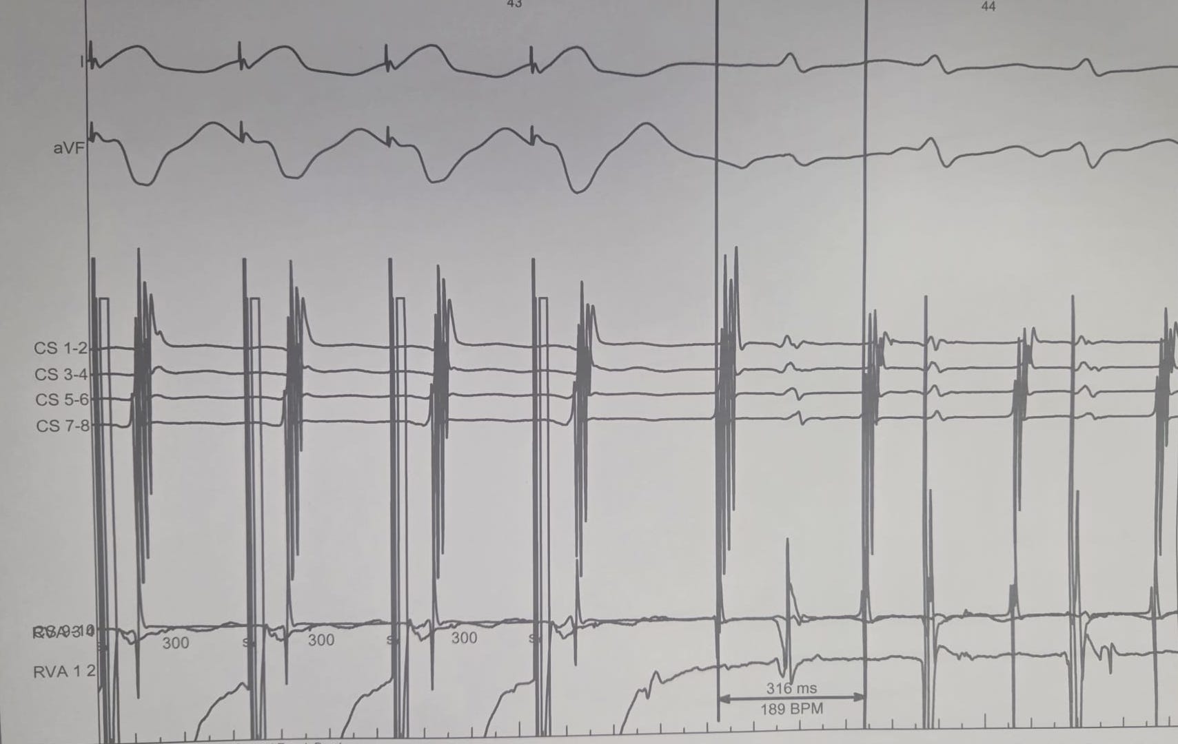 Syncope ? - Dr Synapse